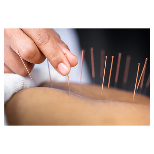 Natural allergy management